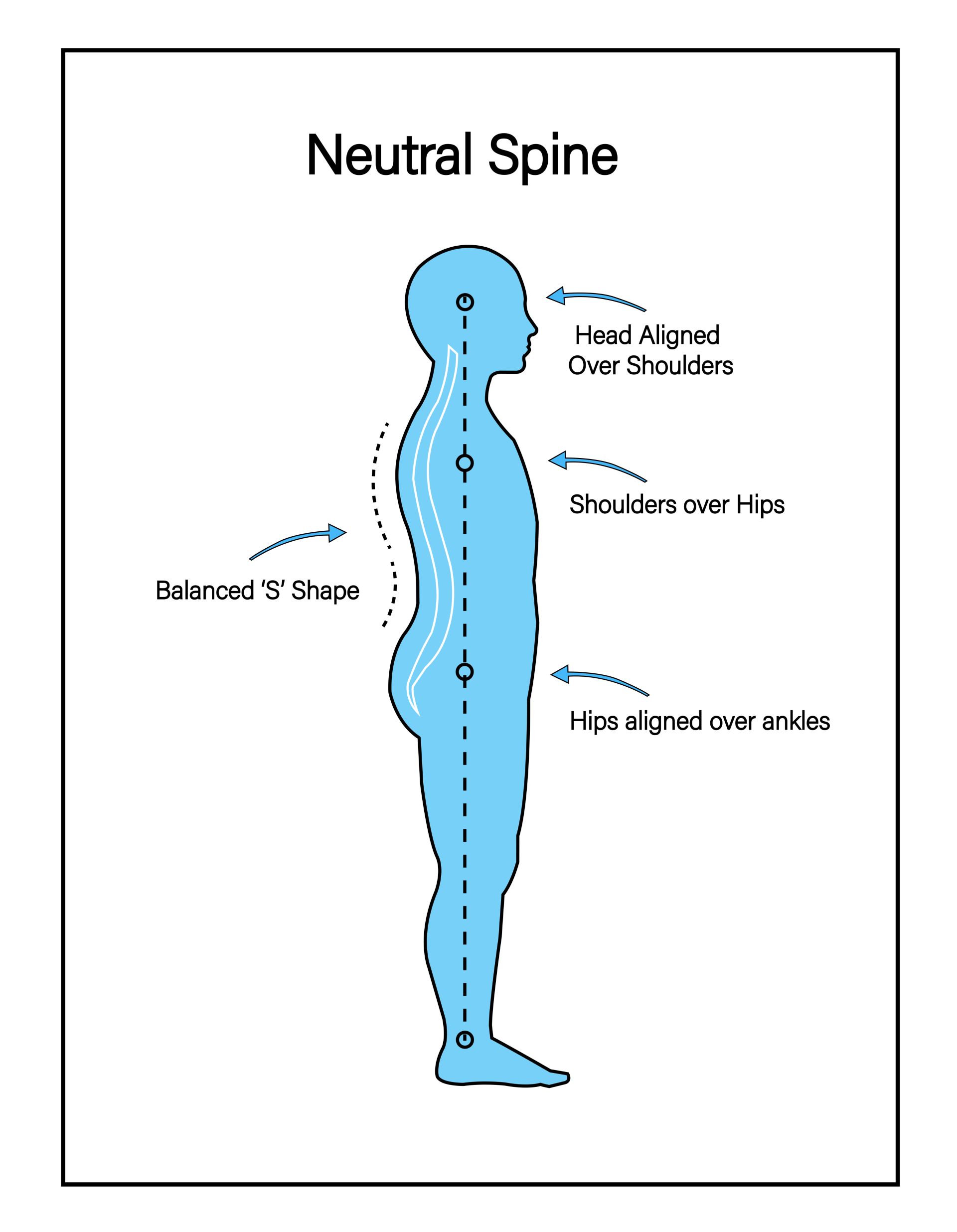 Posture Problems: Causes, Symptoms, and Solutions - Tensegrity Physical